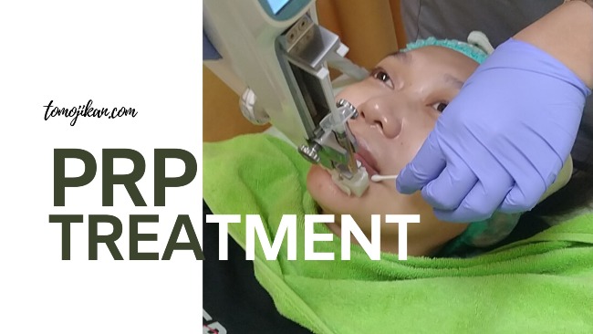 PRP treatment ZAP Clinic